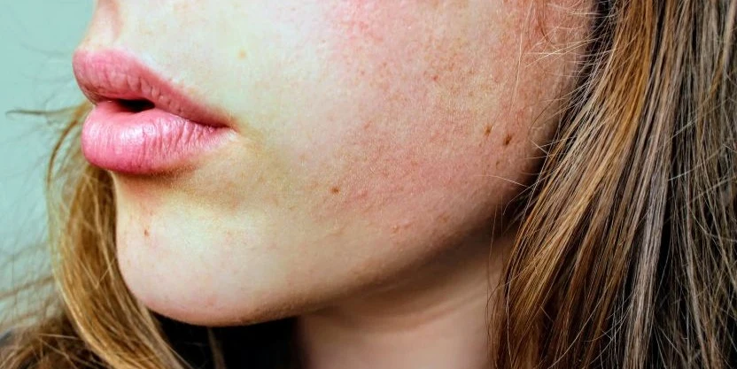 العناية بالبشرة الجافة: أفضل النصائح والمنتجات لحماية بشرتك